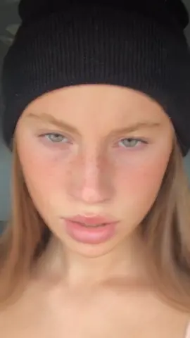 the mosquito bite