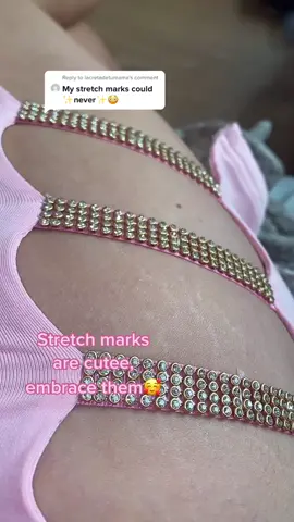 Reply to @lacretadetumama EMBRACE THEM HUN💖💖💖💖 #stretchmarks #fyp