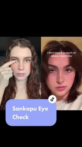 #duet with @peachymother Sanpaku eyes never looked so good #trend #oneeye #fypシ