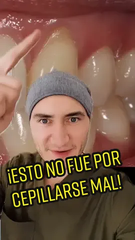¡Su encía NO se perdió por cepillarse mal! Recesión de encía #enciassangrantes #encia #dolordental #fracturadental #dientesblancos #dolordediente