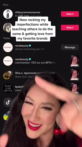 Reply to @rarebeauty 🥲❤️ #greenscreen #fyp #normalizerealskin #realskin #acne #texturedskin #loveyourskin #rarebeauty