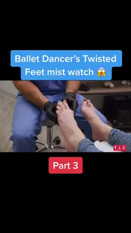 Ballet Dancer’s Twisted Feet #fyp #certientertainment #fypシ #viral #ballet #toe