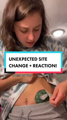 the series of unexpected events that took place in this 🥴 #Type1Diabetes #t1d #Dexcom #SiteChangeThoughts #YesDayChallenge