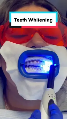 Laser teeth whitening bottom teeth after top teeth veneers. #teeth #teethwhitening #white #dentistry #beforeandafter #how #laser #dentist #cosmetic