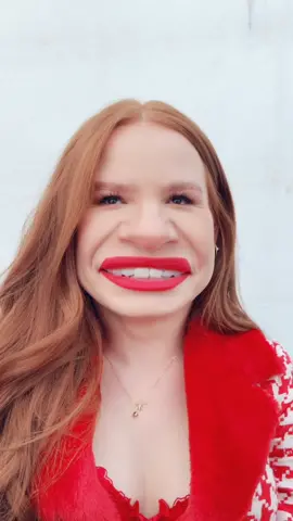 No one is safe from the long face muahahah 🍒
