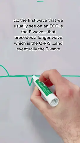 The waveforms on an ECG: P-Q-R-ST #medicine #LearnOnTikTok #tiktokpartner #ecg (IG yazdebull)