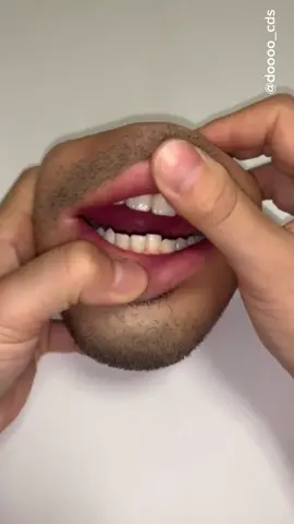 Mom? Come pick me up... I’m scared😬 #trippy #weird #weirdvideos #disturbing #viral #fyp #wtf #scarytiktoks #mouth