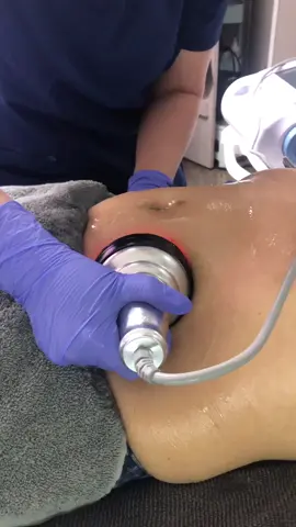 Técnica de cavitacion #cavitation #cavitationtreatment #cavitationmachine #cavitationslimming #radiofrequency #spa #beautytips