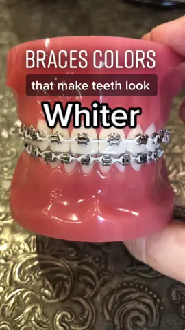 Some of these stain though! 🦷 #braces #smile #bracescolors #goodforyou #orthodontist #orthodontistsoftiktok
