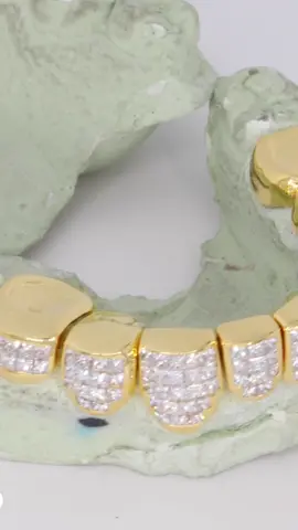 Peep👀these yellow gold invisible set grills🥶they don’t call me number one for no reason💪#diamondboyz #grillz #diamonds #gold #houston#nocap