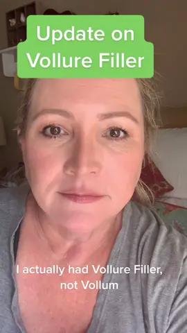 Update on Vollure filler I had above my lip and corners of mouth. #vollure #cougartok #over50 #whiteyy18 #fyp #MomsofTikTok