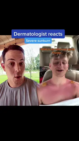 #duet with @timbroom17 is anyone hearing me? #sunburn #spf #skincancer #Summer ￼