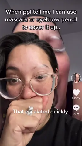 Seriously, thank you all for the kind and encouraging words! Love you all! ❤️#greenscreenvideo #Buffering #vitiligo #myvitiligo #eyelashextension