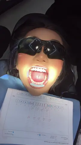 The start of my Invisalign journey! 🙌🏼#invisalign #summervlog #teethtok