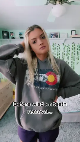 Before and after wisdom teeth removal 😅 #wisdomteethremoval #wisdomteeth #fy