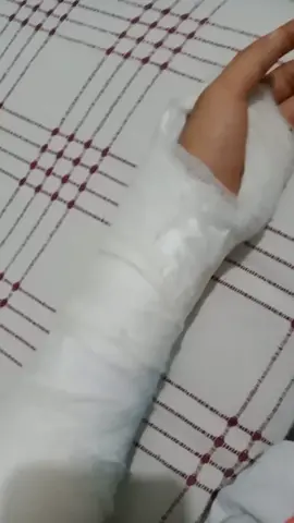 arkadaşlar  bisikletten düştüm kolum kırıldı