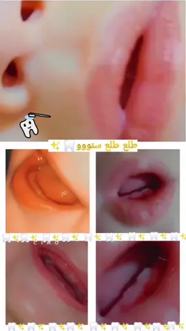 طلع طلع سنو  .مافي مبروك لا سنونات يسوفي 😍❤️🤭انشالله عقبيل باقي الا اسنان ياعمري 🥺طلعوني اكسبلور لا خاطر يسوفي #متابعه_ولايك_واكسبلور_احبكم