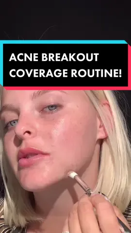 I’m breaking out.. here’s my pre-makeup acne coverage routine! @elfyeah @dragunbeauty #learnhow #acneskin #acne #makeuphacks #promua
