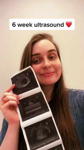 Update! #pregnant #rainbowbaby #ultrasound #6weeks #MicroRaveWithRoni #foryou #foryoupage #fypシ #ChewyChattyPets