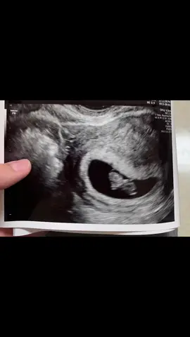 #babygirl