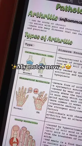 My productivity has increased by 1000% 🤩 #nursingnotes #nursingschool #notes #ipadnotes #nursingtiktok