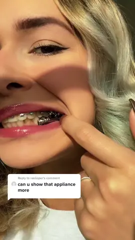 Reply to @rexiioper #jawproblems #herbstappliance #asmrmouthsounds #metalmouth