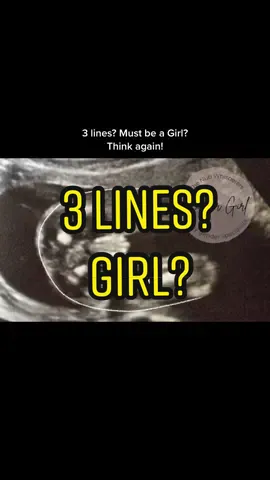 3 lines doesn’t always mean it’s a girl! Check out the blog in the webpage! 🤍 #babyboyorbabygirl #genderreveal #genderprediction #baby #pottyshot