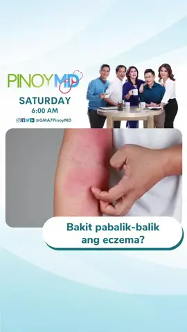 Bakit nga ba pabalik-balik ang eczema sa balat? #SkinTok #PinoyMD #Tiktoknews #fyp #NewsPH