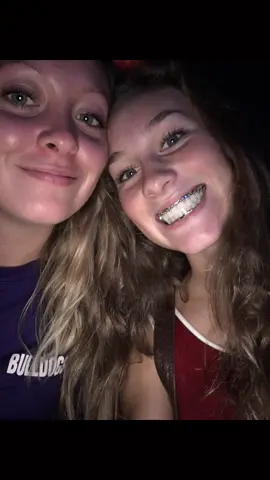 Started college with my jaw wired shut from getting punched in the face by a man while driving home from a party