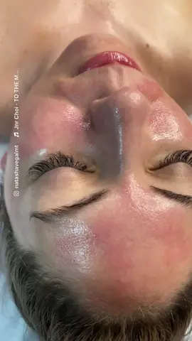 If you’re not going into 2022 glowing then what is you doing bby👏🏽🙌🏽 #esthetician #facial #skintighening #microneedling