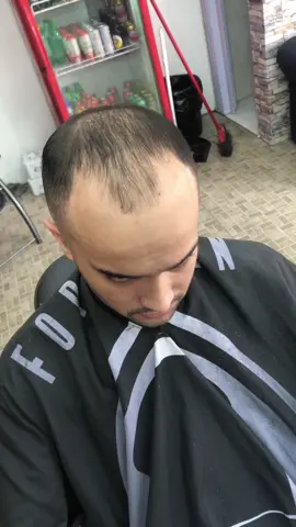 Deu diferença ? #barber #barbershop #careca #cabelo #barbeiro #fy #tiktok #homem #cortedecabelo #trabalho #feshion