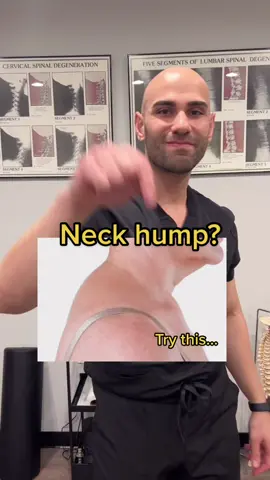 Neck hump? Try this and share! #neck #neckhump #techneck #forwardheadposture #educational #advice  #helpfultips