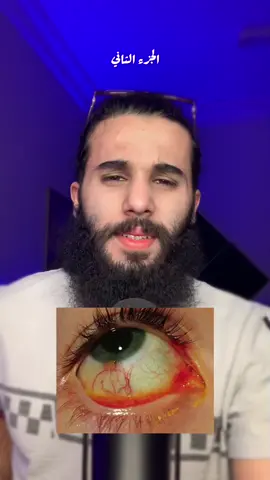 #انس_اكشن
