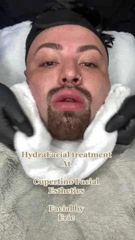 HydraFacial by Eric at “Cupertino Facial Esthetics” 🧖🏼‍♀️ #WhenRiftanSays #ThanksandGiving #MakeABunchHappen #MyBrawlSuper #fyp #foryoupage