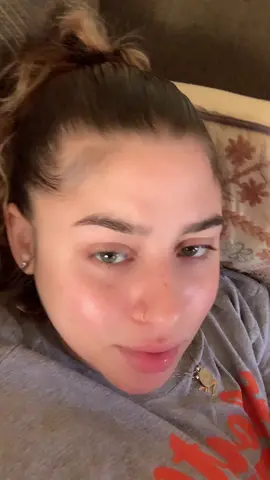 When you’re sick so you’re the ugly bitch 😭🥴😔😥🤮🤢🤕😷🤧😖😖 dry lips and all