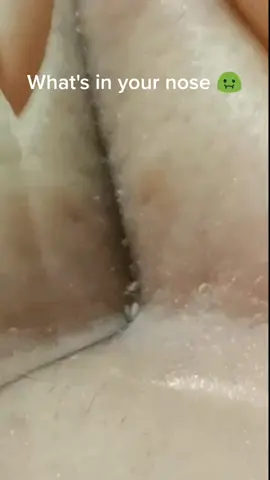 Too scary #facecare #skincare #pop #pores #pimple