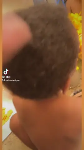 Tryna grow his hair out 🥰 #fyp #braidsoftiktok #gripgame #braidtok #foryou