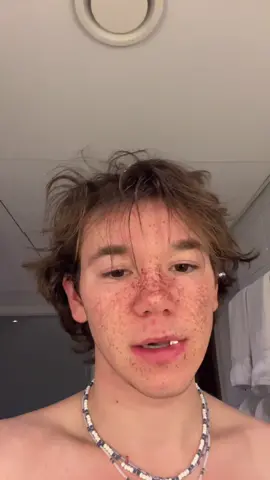 I miss my freckles #fyp #foryoupage #foryou #freckles