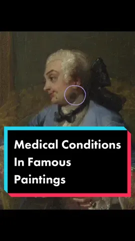 Calling all doctors #art #medical #arttok #disease #fyp #wow #LearnOnTikTok #viralvideo