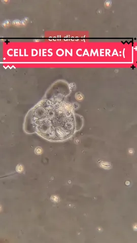 poor cell :( #microscopic #microscope #microscopy #cellbio #microbiology #micro #scienceart #cells #microscopes #research #cellbiology #micro #micron
