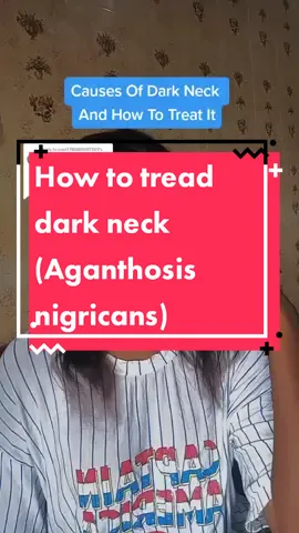 Reply to @user1790005107307  💖 #darkneck #darkneckremedy #acanthosisnigricans #ceravesacream #theordinaryglycolicacid #skincaretipsandtricks