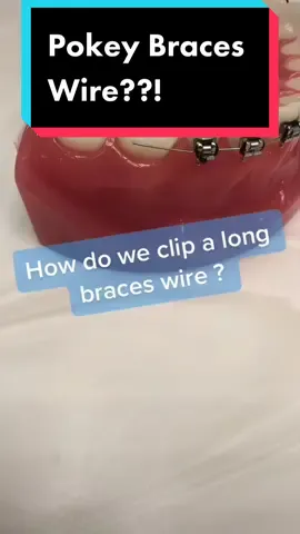 #ouch #braces #orthodontist #orthodontics #smile #dentist
