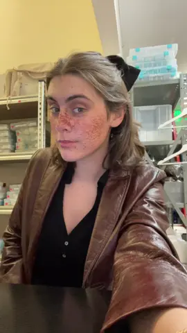 These freckles with the bow ?????? Wow