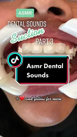 #asmrsounds #asmr #dentist #smile #orthodontist #orthodontics #orthodontistsoftiktok