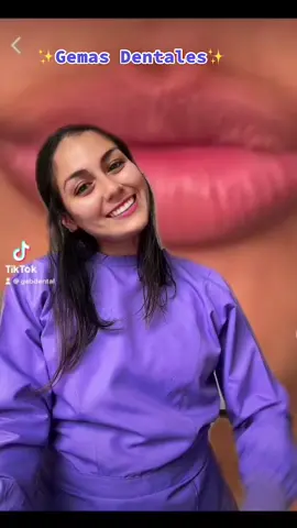 Gemas Dentales💎⁉️ Todo lo que debes saber antes de comprarlos ‼️ #dentista #dentista #mirafloreslima #dientesperfectos #limaperu#diseñodesonrisa #me