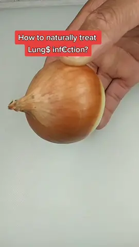 I love onions#asthma#learnfromeliyahmashiach#eliyahmashiach