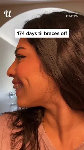 This girl documented her braces journey! 🦷 (@RubyNC) #braces #bracesoff #teeth #teethcare #makeover #transformation #fyp #foryoupage