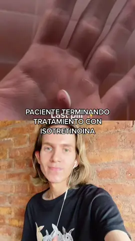 #dúo con @rodriguezpato01 Esta medicación salva vidas #skincareargentina #skincare #acne #isotretinoina #roaccutan #accutane