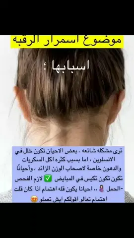 اسباب إسمرار الرقبة #fypシ#fypシ゚viral #إكسبلور؛🔥#متابعه_ليصلك_كل_جديد_عشان_الجديد#المغرب🇲🇦#دعمكم↙️#ماسكات_طبيعية#بارطاجي#لايكات#نصائح_مفيدة✅🔥#❤️