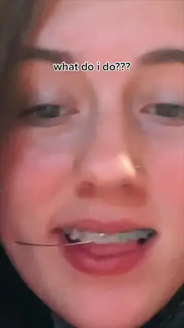 Orthodontist Reacts 😬 #braces #teeth #LearnOnTikTok  @bobbi steckbauer